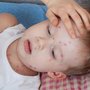 In rare cases chickenpox virus can lead to inflammation of the brain and servere pneumonia.