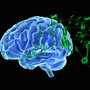 Forskningsprojektets deltagere fik skannet deres hjerner for at lokalisere den kommunikation, der foregår mellem forskellige områder i hjernen, når de lyttede til musik. Foto: Colourbox