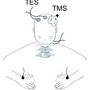 Schematic view of non-invasive brain stimulation using TES or TMS. Recording electrodes from the high cervical cord at epidural level and from hand muscles are also schematically illustrated.