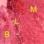Vævssnit af parodontitis. Mundslimhinden (M) med migrerende leukocytter (L) ses i tæt kontakt med bakterier i tandbelægninger (B).